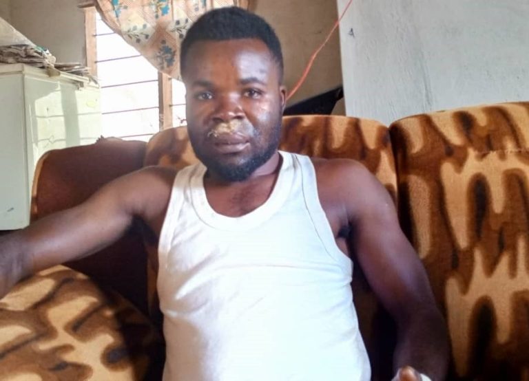 Gundu Avalumu, the robbery victim.