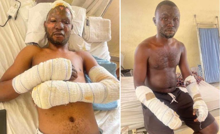 Four Hospitalised In Abuja From Inverter Explosion, Residential Apartment Damaged Odesina Oyebayo and Apeh John Daniel