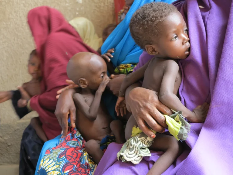 250,000 Children Suffering From Severe Acute Malnutrition In Zamfara – UNICEF For illustration purpose only